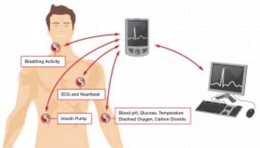 Xarxa de sensors: coneixeu-ho tot sobre la xarxa d’àrees corporals BAN